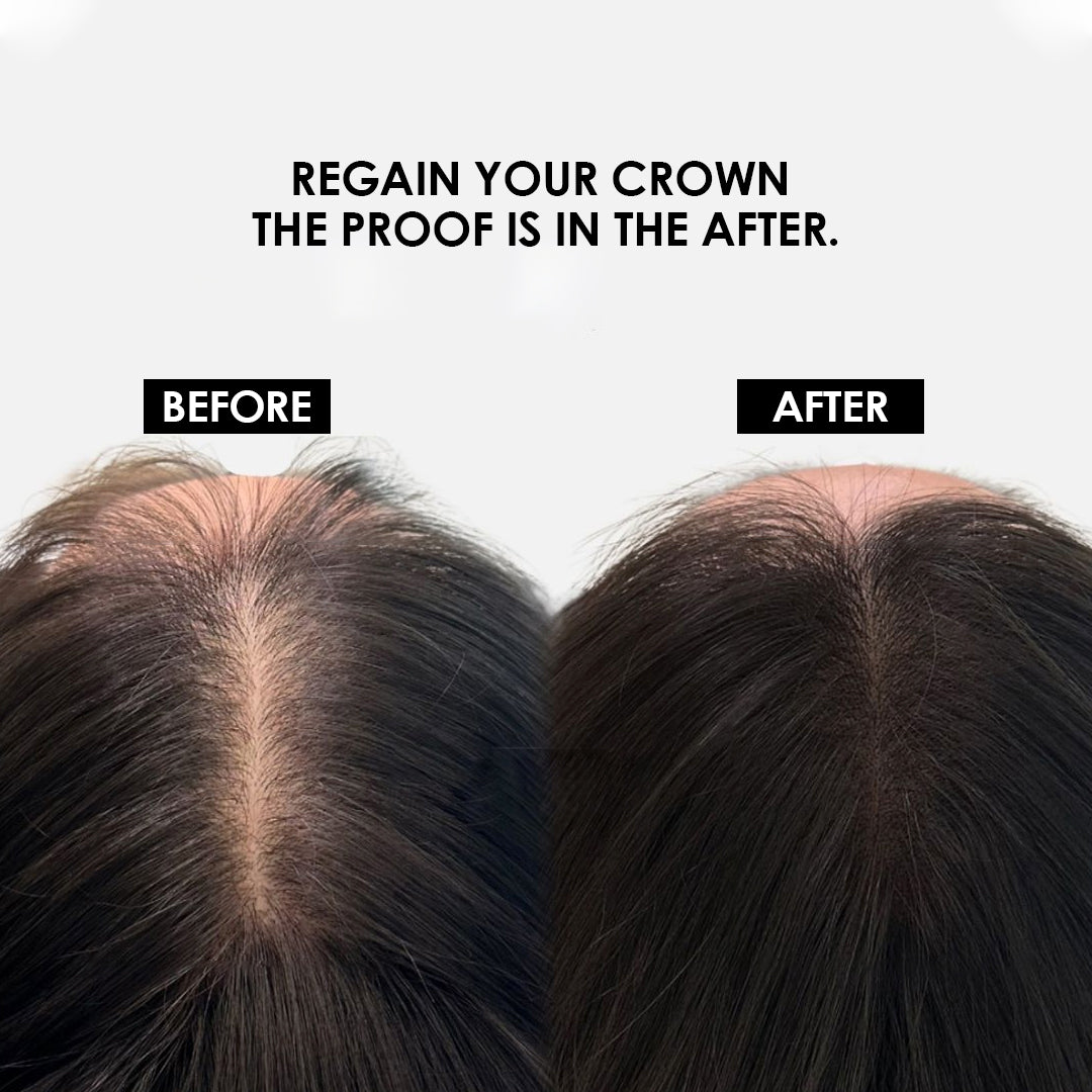 Hair Pure Super Lux Advanced Actives Shampoo with Biotin, Aloe Vera & Vitamin E | Strengthens Hair, Reduces Breakage & Frizz | Boosts Shine, Restores Scalp pH Balance | Professional Expert Care – 250ml